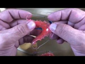 Cómo reparar un retenedor de ortodoncia